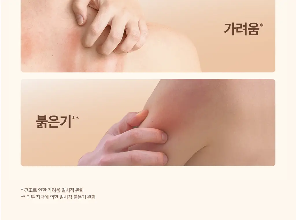 [극건성용] 아비노 더멕사 아토 바디크림 200ml 상세페이지 9